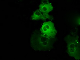 m00245 2 anti btk mouse monoclonal antibody clone id oti3a2 if testing 8