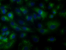 m00245 2 anti btk mouse monoclonal antibody clone id oti3a2 if testing 9