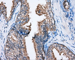 Immunohistochemical staining of paraffin-embedded prostate tissue within the normal limits using anti-BTK mouse monoclonal antibody