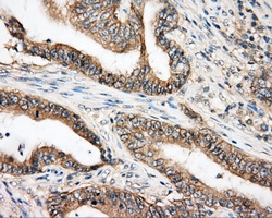 m00245 2 anti btk mouse monoclonal antibody clone id oti3a2 ihc testing 4