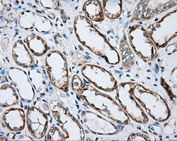 m00245 2 anti btk mouse monoclonal antibody clone id oti3a2 ihc testing 5
