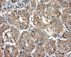 m00245 2 anti btk mouse monoclonal antibody clone id oti3a2 ihc testing 6