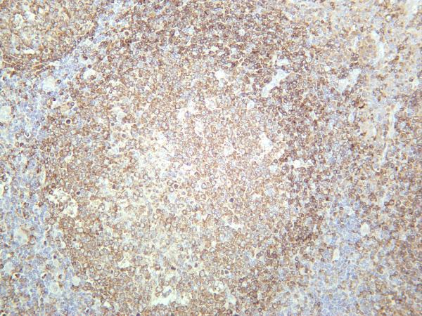 Human tonsil was stained with anti-BTK rabbit antibody