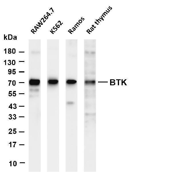 Various whole cell lysates were separated by 4-20% SDS-PAGE, and the membrane was blotted with anti-BTK antibody