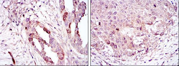 Immunohistochemistry validation of AURKA using Anti-ARK-1 AURKA Monoclonal Antibody (M00246-6)