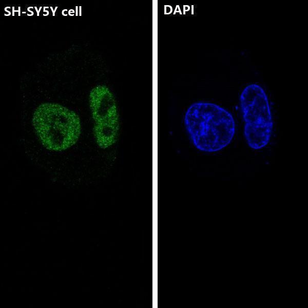 Immunofluorescent analysis of SH-SY5Y cells, using ARID1A Antibody