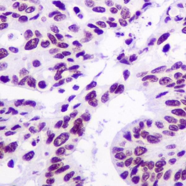 m00247 1 ihc