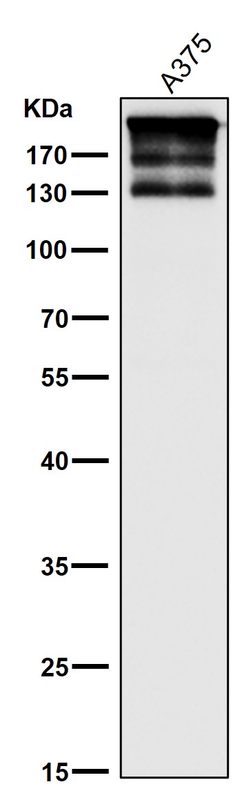 All lanes use the Antibody at 1:1K dilution for 1 hour at room temperature