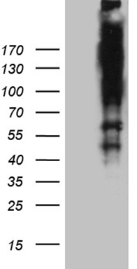 HEK293T cells were transfected with the pCMV6-ENTRY control (Left lane) or pCMV6-ENTRY ARID1A (Right lane) cDNA for 48 hrs and lysed
