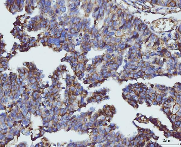  IHC analysis of CD147/Emmprin using anti-CD147/Emmprin antibody (M00248-4)