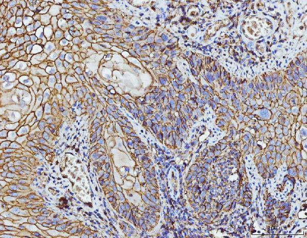  IHC analysis of CD147/Emmprin using anti-CD147/Emmprin antibody (M00248-4)