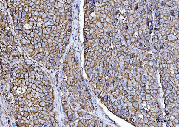 m00248 4 cd147 primary antibodies ihc testing 4