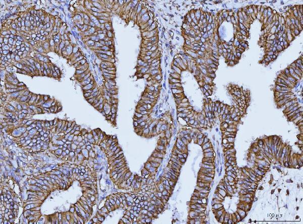 m00248 4 cd147 primary antibodies ihc testing 7