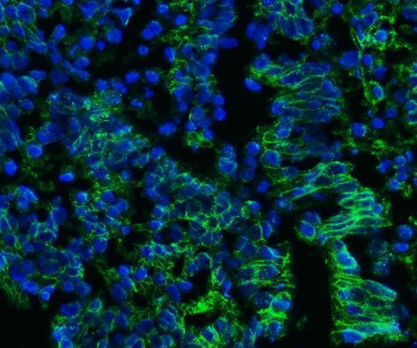 m00248 5 cd147 primary antibodies if testing 9