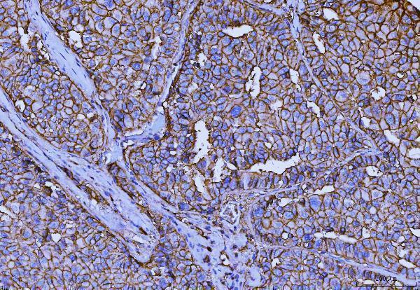  IHC analysis of CD147/Emmprin using anti-CD147/Emmprin antibody (M00248-5)