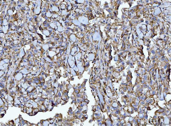  IHC analysis of CD147/Emmprin using anti-CD147/Emmprin antibody (M00248-5)
