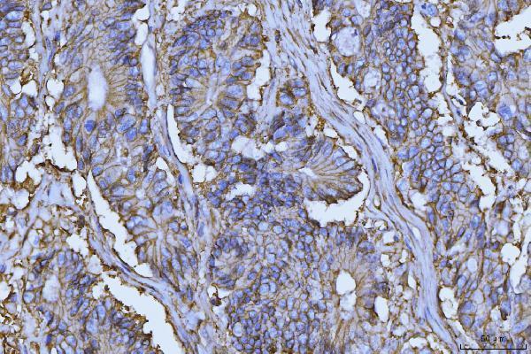 m00248 5 cd147 primary antibodies ihc testing 5