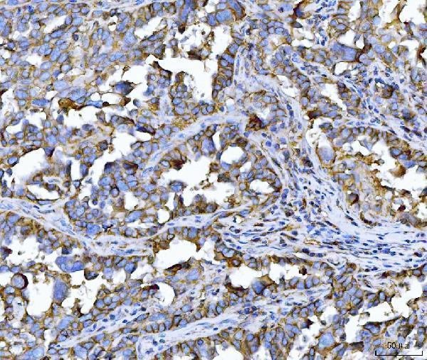 m00248 5 cd147 primary antibodies ihc testing 6