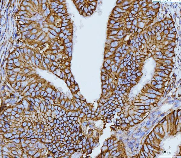 m00248 5 cd147 primary antibodies ihc testing 7