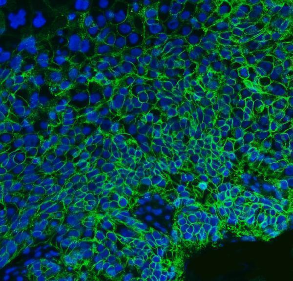 m00248 6 cd147 primary antibodies if testing 8