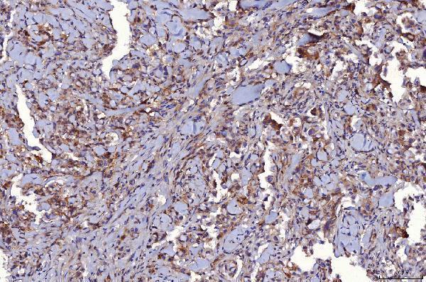  IHC analysis of CD147/Emmprin using anti-CD147/Emmprin antibody (M00248-6)