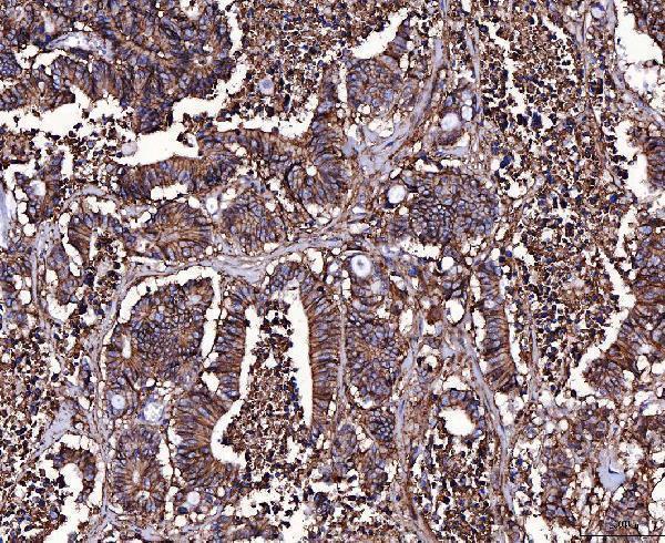  IHC analysis of CD147/Emmprin using anti-CD147/Emmprin antibody (M00248-6)