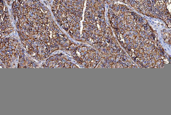 m00248 6 cd147 primary antibodies ihc testing 5