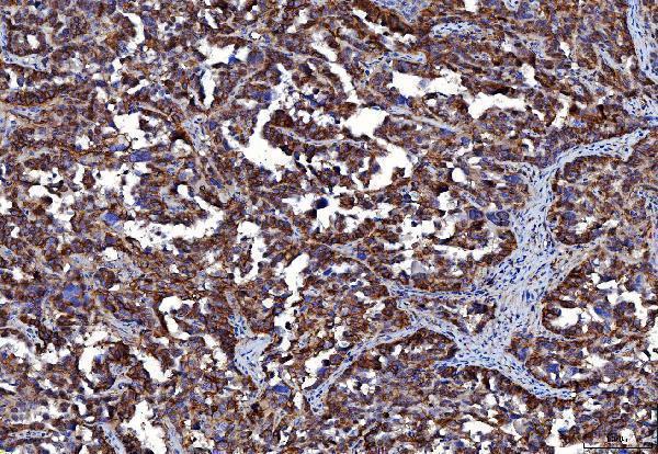 m00248 6 cd147 primary antibodies ihc testing 6