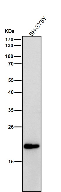 All lanes use the Antibody at 1:1K dilution for 1 hour at room temperature