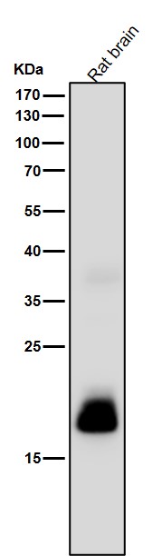 All lanes use the Antibody at 1:1K dilution for 1 hour at room temperature