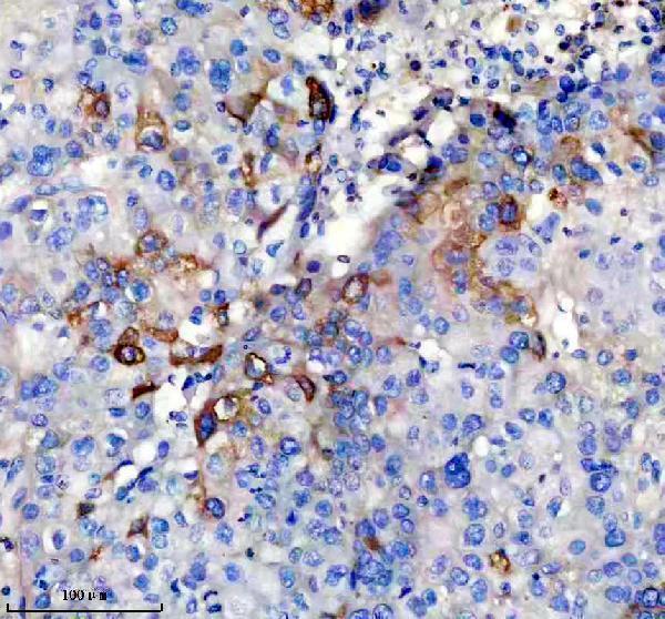 IHC analysis of CRP using anti-CRP antibody (M00249)
