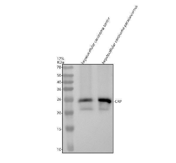 Western blot analysis of CRP using anti-CRP antibody (M00249)