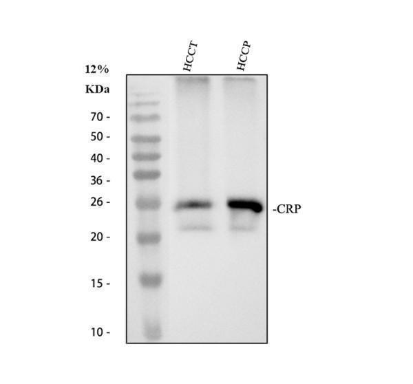 m00249 crp primary antibodies wb testing 1_1