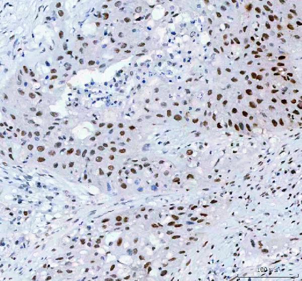  IHC analysis of HSF1 using anti-HSF1 antibody (M00250-1)