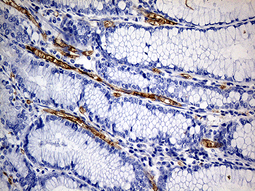 m00251 1 anti angiotensin converting enzyme 1 ace mouse monoclonal antibody clone id oti2c8 ihc testing 3