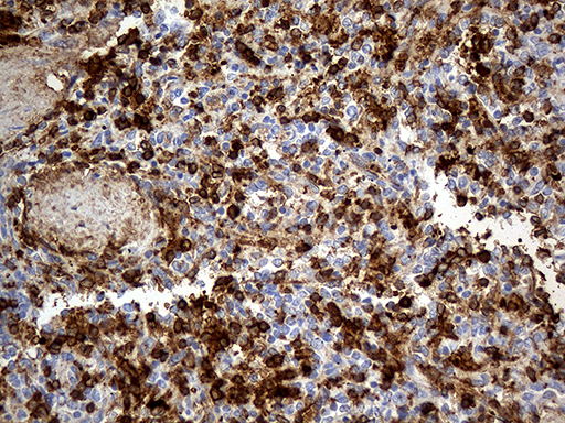 m00251 1 anti angiotensin converting enzyme 1 ace mouse monoclonal antibody clone id oti2c8 ihc testing 4