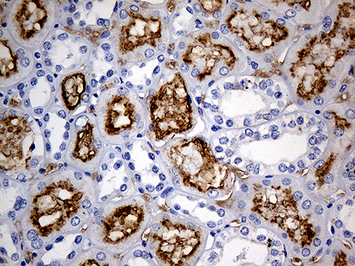 m00251 1 anti angiotensin converting enzyme 1 ace mouse monoclonal antibody clone id oti2c8 ihc testing 5