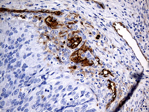 m00251 1 anti angiotensin converting enzyme 1 ace mouse monoclonal antibody clone id oti2c8 ihc testing 6