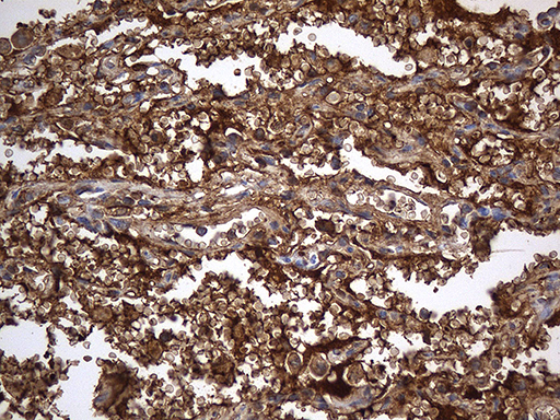 m00251 1 anti angiotensin converting enzyme 1 ace mouse monoclonal antibody clone id oti2c8 ihc testing 7