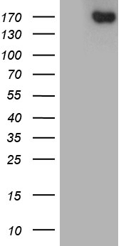 m00251 1 anti angiotensin converting enzyme 1 ace mouse monoclonal antibody clone id oti2c8 wb testing 1