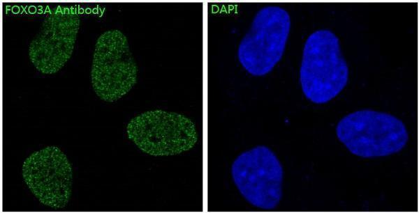 Immunofluorescent analysis of Hela cells, using FoxO3a Antibody 