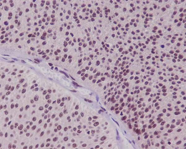 m00252 1 ihc
