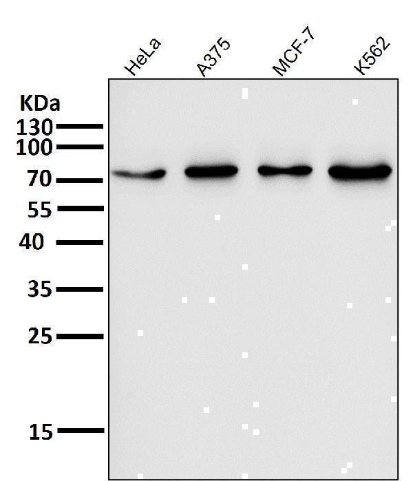 All lanes use the Antibody at 1:1K dilution for 1 hour at room temperature