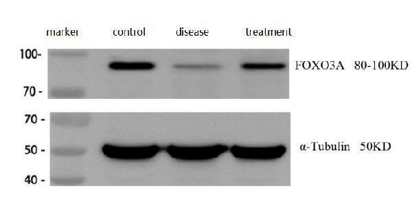 m00252 foxo3a primary antibodies wb review 1