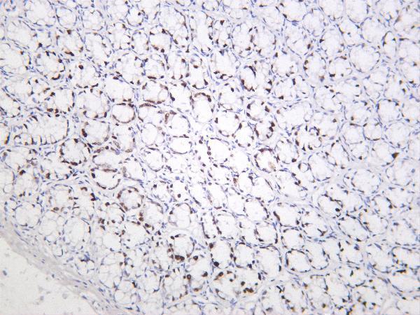 Rat colon was stained with Anti-Ki67 rabbit antibody