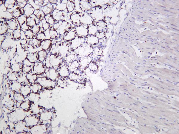 Mouse colon was stained with Anti-Ki67 rabbit antibody