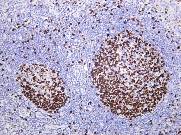 Human tonsil was stained with Anti-Ki67 rabbit antibody