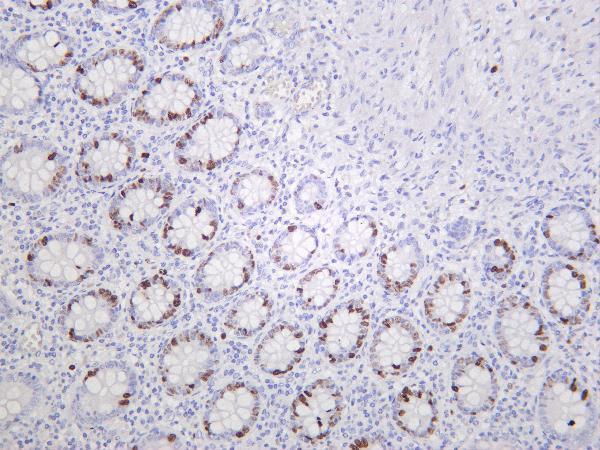 m00254 10 mki67 primary antibodies ihc testing 4