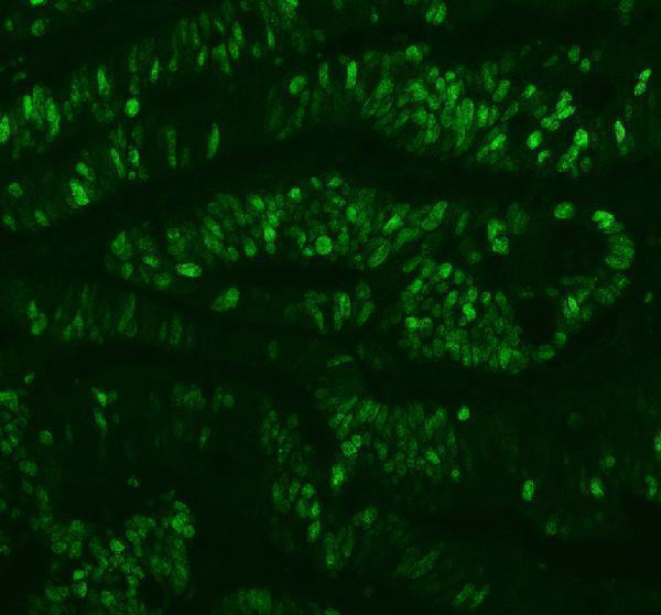 m00254 11 ki67 primary antibodies if testing 1