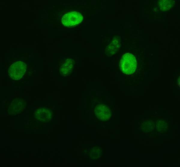 m00254 11 ki67 primary antibodies if testing 2